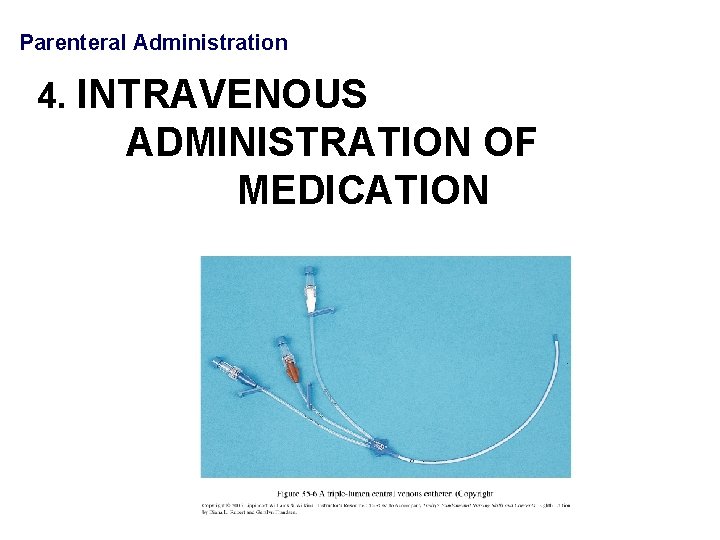 Parenteral Administration 4. INTRAVENOUS ADMINISTRATION OF MEDICATION 