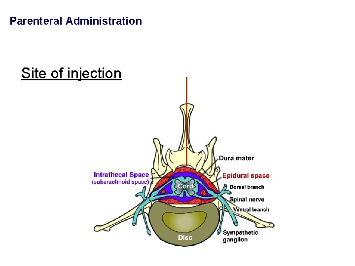 Parenteral Administration Site of injection 