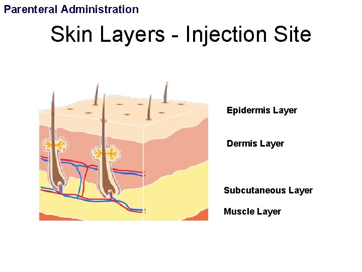 Parenteral Administration Skin Layers - Injection Site Epidermis Layer Dermis Layer Subcutaneous Layer Muscle