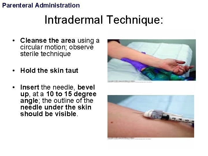 Parenteral Administration Intradermal Technique: • Cleanse the area using a circular motion; observe sterile