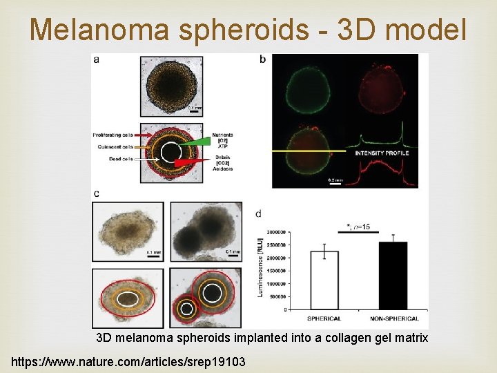 Melanoma spheroids - 3 D model 3 D melanoma spheroids implanted into a collagen