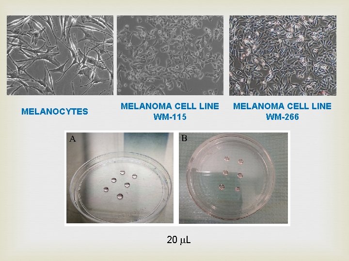 MELANOCYTES MELANOMA CELL LINE WM-115 20 L MELANOMA CELL LINE WM-266 