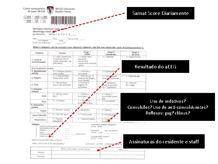 Sarnat Score Diariamente Resultado do a. EEG Uso de sedativos? Convulsões? Uso de anti-convulsivantes?