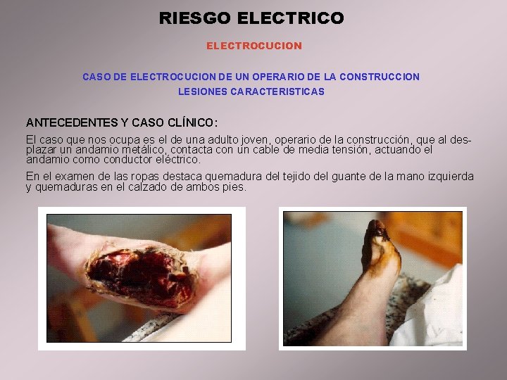 RIESGO ELECTRICO ELECTROCUCION CASO DE ELECTROCUCION DE UN OPERARIO DE LA CONSTRUCCION LESIONES CARACTERISTICAS