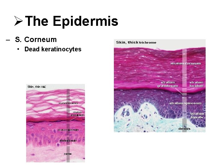 ØThe Epidermis – S. Corneum • Dead keratinocytes 