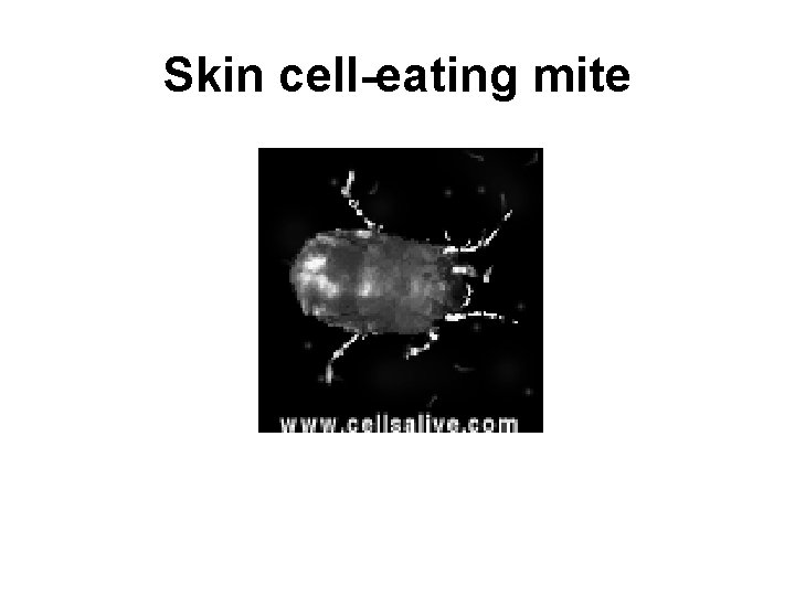 Skin cell-eating mite 