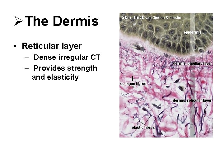 ØThe Dermis • Reticular layer – Dense irregular CT – Provides strength and elasticity