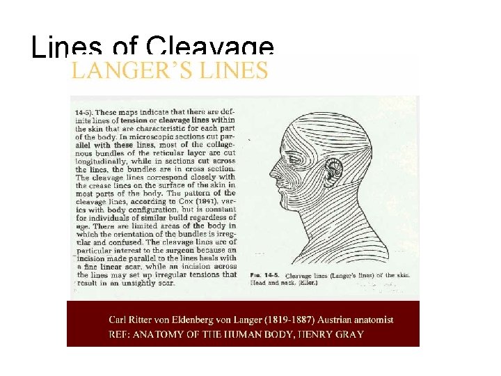 Lines of Cleavage • 