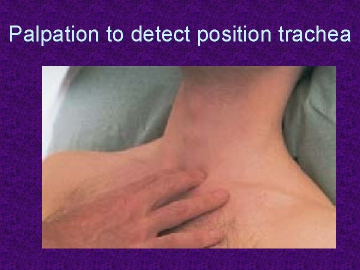 Palpation to detect position trachea 