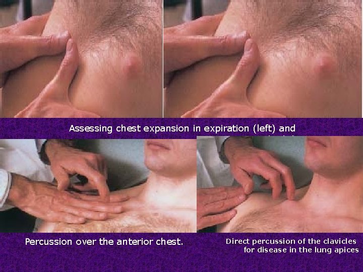 Assessing chest expansion in expiration (left) and inspiration (right). Percussion over the anterior chest.