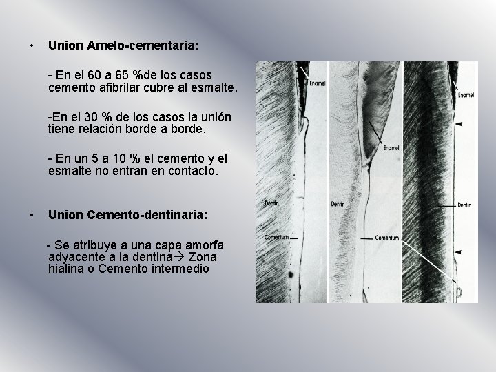  • Union Amelo-cementaria: - En el 60 a 65 %de los casos cemento