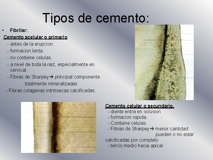 Tipos de cemento: • Fibrilar: Cemento acelular o primario - antes de la erupcion.