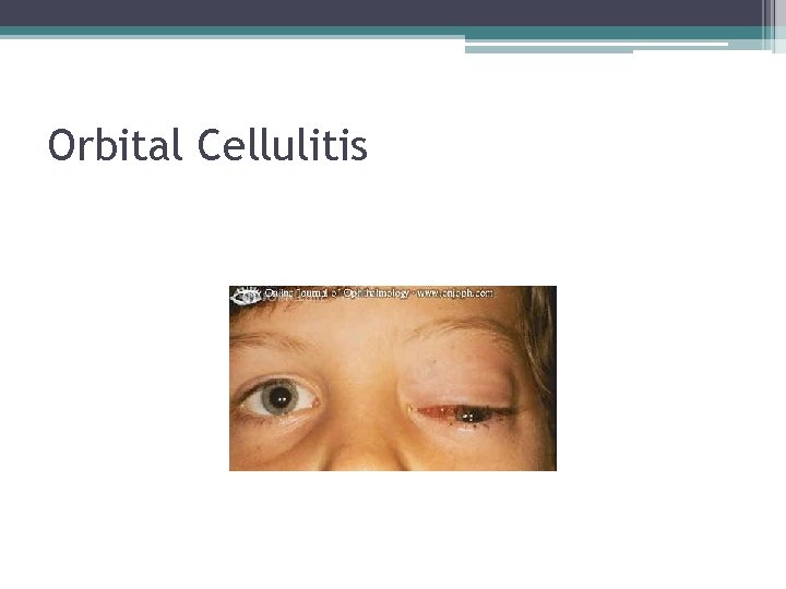 Orbital Cellulitis 