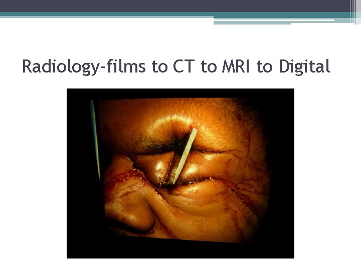 Radiology-films to CT to MRI to Digital 