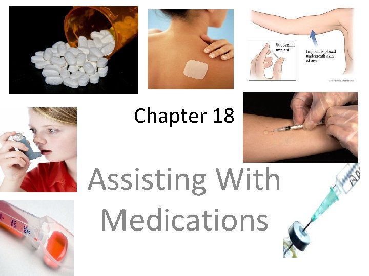 Chapter 18 Assisting With Medications 