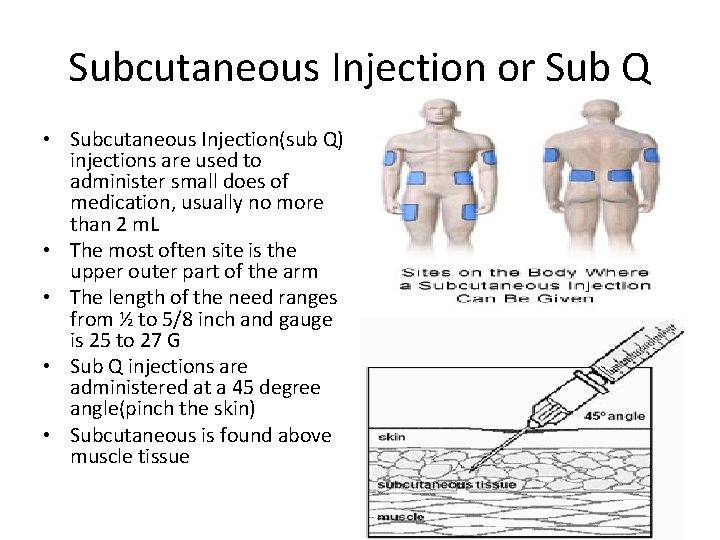 Subcutaneous Injection or Sub Q • Subcutaneous Injection(sub Q) injections are used to administer