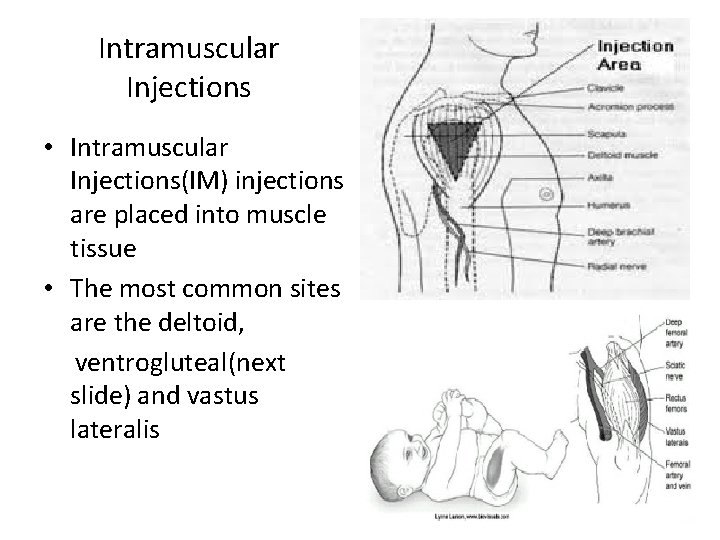 Intramuscular Injections • Intramuscular Injections(IM) injections are placed into muscle tissue • The most