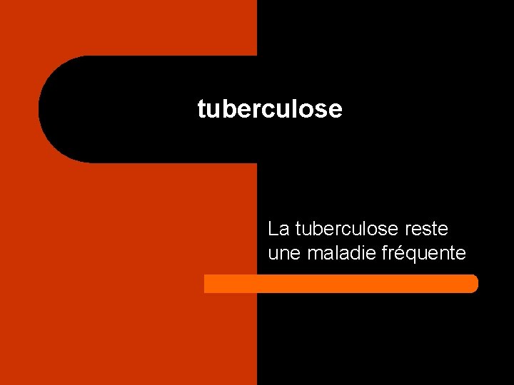 tuberculose La tuberculose reste une maladie fréquente 