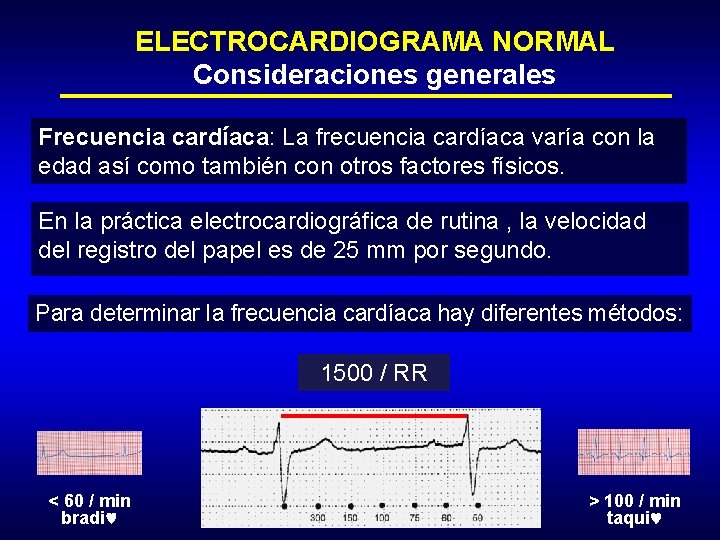 ELECTROCARDIOGRAMA NORMAL Consideraciones generales Frecuencia cardíaca: La frecuencia cardíaca varía con la edad así