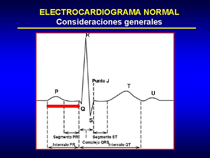 ELECTROCARDIOGRAMA NORMAL Consideraciones generales 