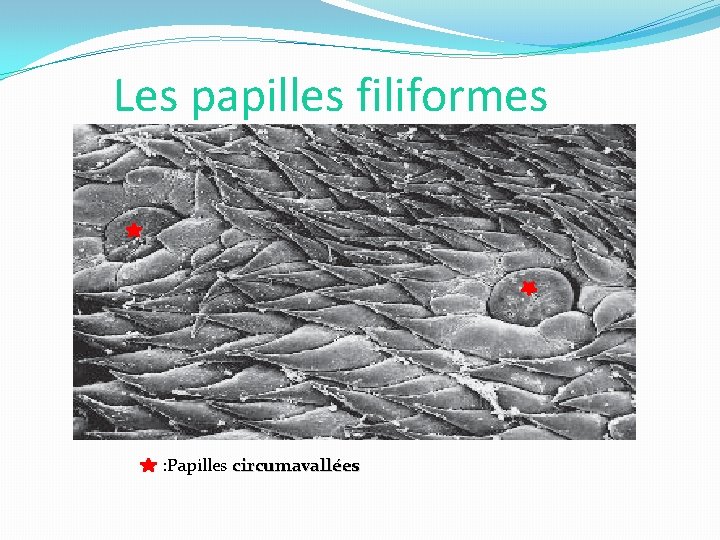 Les papilles filiformes : Papilles circumavallées 