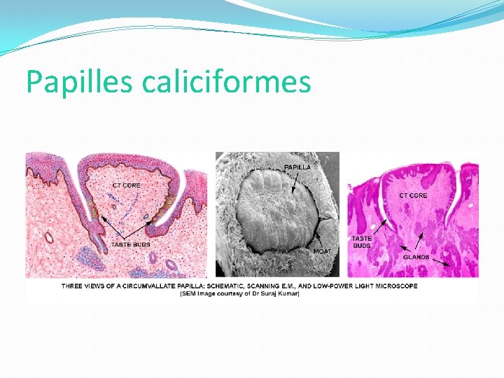 Papilles caliciformes 