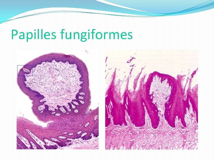 Papilles fungiformes 