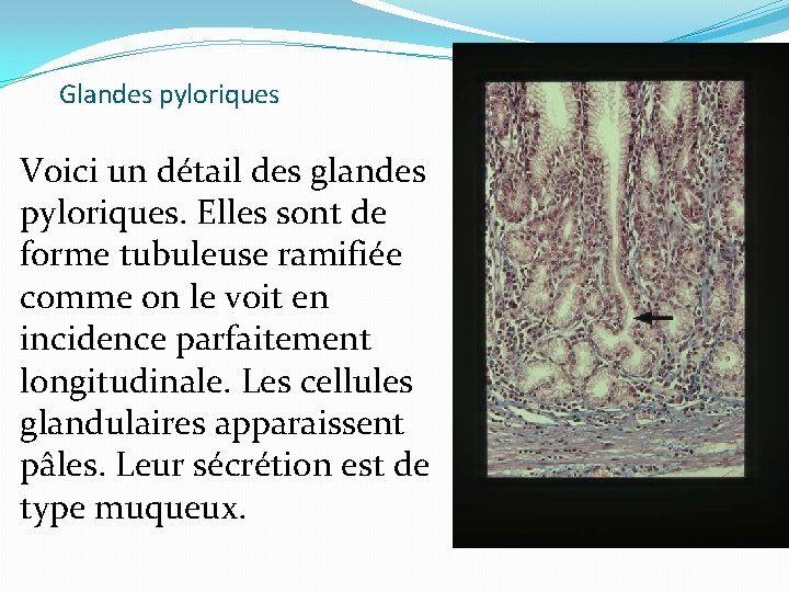 Glandes pyloriques Voici un détail des glandes pyloriques. Elles sont de forme tubuleuse ramifiée