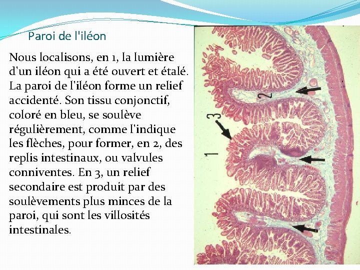 Paroi de l'iléon Nous localisons, en 1, la lumière d'un iléon qui a été