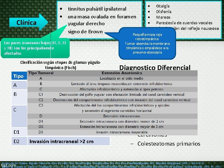 • Clínica Otalgia • tinnitus pulsátil ipsilateral • Disfonia • una masa ovalada • Clínica Otalgia • tinnitus pulsátil ipsilateral • Disfonia • una masa ovalada