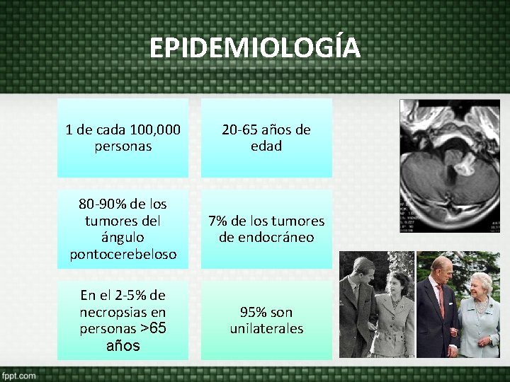 EPIDEMIOLOGÍA 1 de cada 100, 000 personas 20 -65 años de edad 80 -90% EPIDEMIOLOGÍA 1 de cada 100, 000 personas 20 -65 años de edad 80 -90%