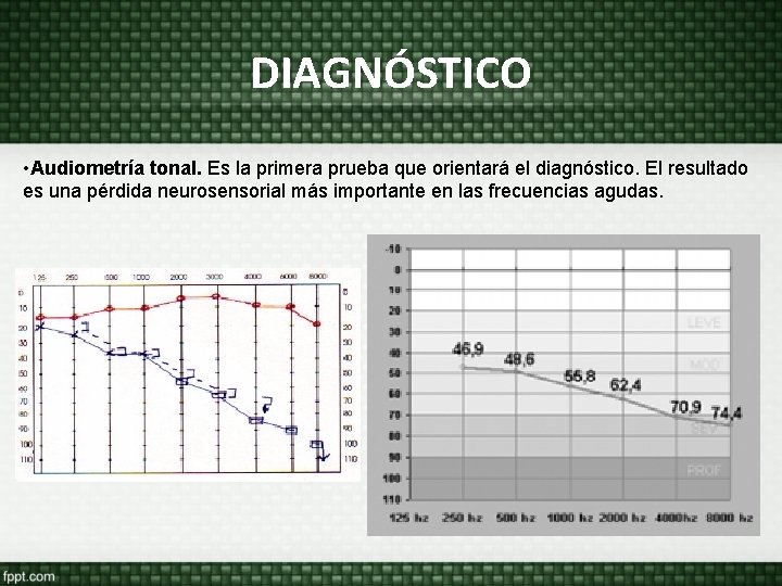 DIAGNÓSTICO • Audiometría tonal. Es la primera prueba que orientará el diagnóstico. El resultado DIAGNÓSTICO • Audiometría tonal. Es la primera prueba que orientará el diagnóstico. El resultado