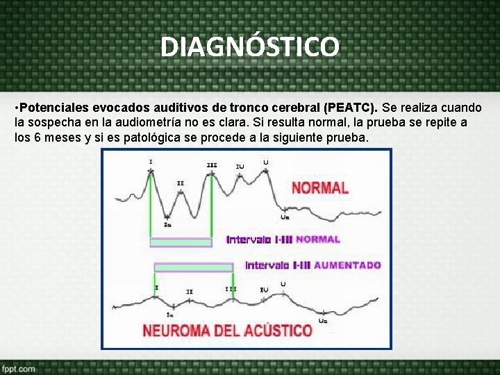 DIAGNÓSTICO • Potenciales evocados auditivos de tronco cerebral (PEATC). Se realiza cuando la sospecha DIAGNÓSTICO • Potenciales evocados auditivos de tronco cerebral (PEATC). Se realiza cuando la sospecha
