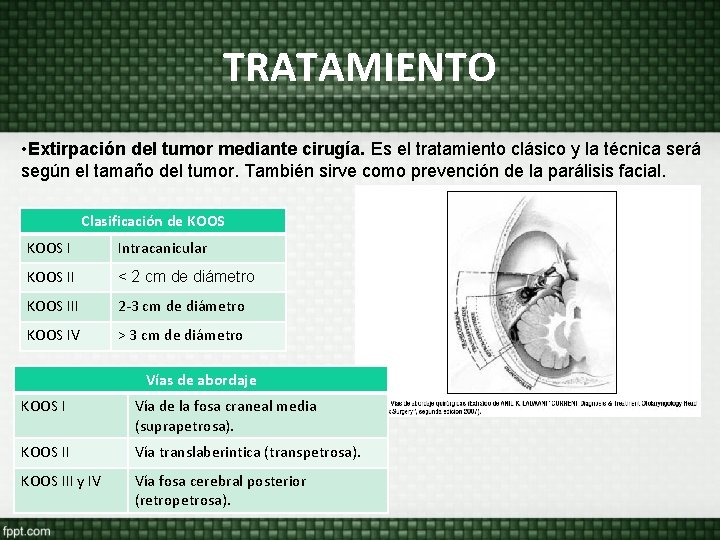 TRATAMIENTO • Extirpación del tumor mediante cirugía. Es el tratamiento clásico y la técnica TRATAMIENTO • Extirpación del tumor mediante cirugía. Es el tratamiento clásico y la técnica