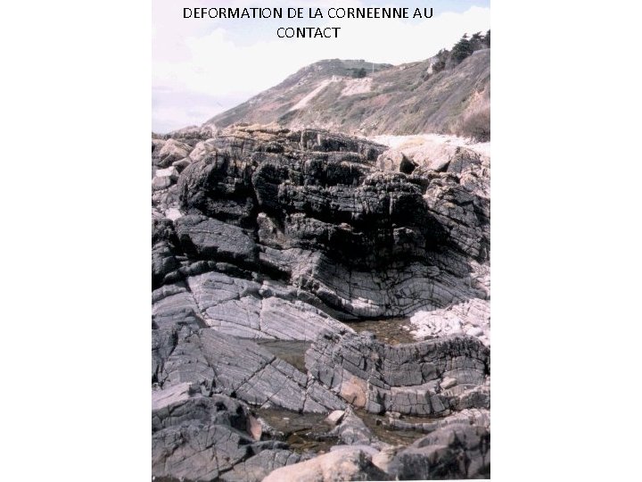 DEFORMATION DE LA CORNEENNE AU CONTACT DEFORMATION DE LA CORNEENNE AU CONTACT