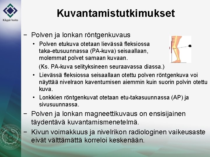 Kuvantamistutkimukset − Polven ja lonkan röntgenkuvaus • Polven etukuva otetaan lievässä fleksiossa taka-etusuunnassa (PA-kuva)