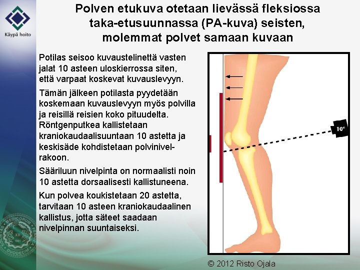 Polven etukuva otetaan lievässä fleksiossa taka-etusuunnassa (PA-kuva) seisten, molemmat polvet samaan kuvaan Potilas seisoo