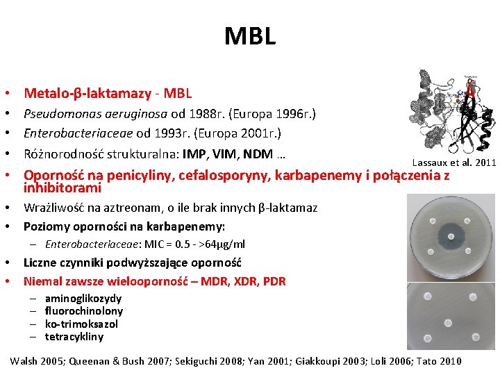 MBL • Metalo-β-laktamazy - MBL • Pseudomonas aeruginosa od 1988 r. (Europa 1996 r.