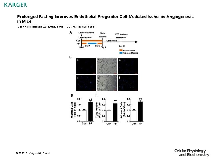 Prolonged Fasting Improves Endothelial Progenitor Cell-Mediated Ischemic Angiogenesis in Mice Cell Physiol Biochem 2016;