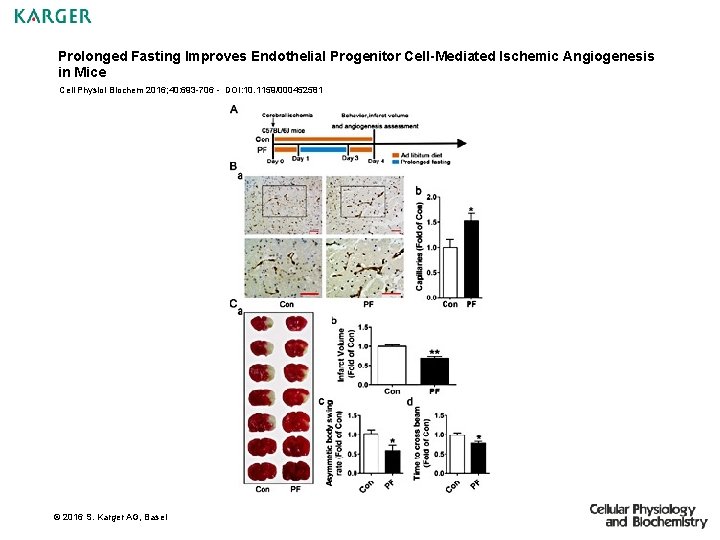 Prolonged Fasting Improves Endothelial Progenitor Cell-Mediated Ischemic Angiogenesis in Mice Cell Physiol Biochem 2016;