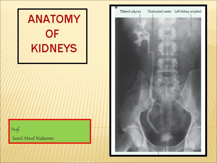 ANATOMY OF KIDNEYS Prof. Saeed Abuel Makarem 