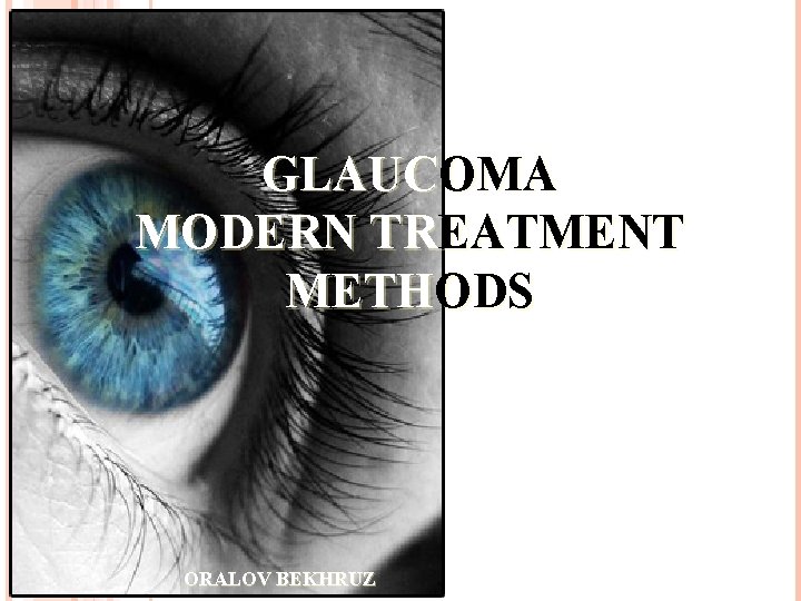 GLAUCOMA MODERN TREATMENT METHODS ORALOV BEKHRUZ 
