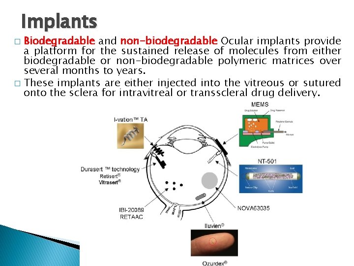 Implants Biodegradable and non-biodegradable Ocular implants provide a platform for the sustained release of Implants Biodegradable and non-biodegradable Ocular implants provide a platform for the sustained release of