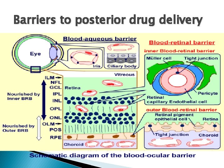 Barriers to posterior drug delivery Barriers to posterior drug delivery