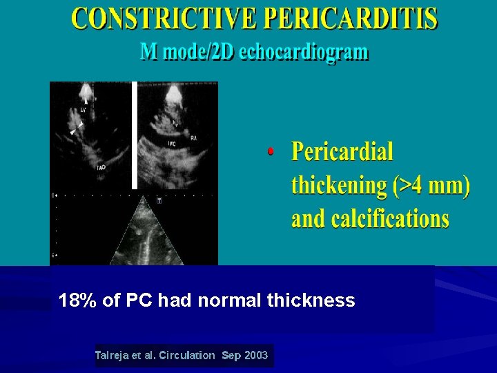 18% of PC had normal thickness 