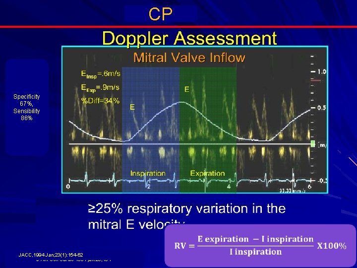 CP Specificity 67%, Sensibility 86% JACC, 1994 Jan; 23(1): 154 -62 J Am Coll