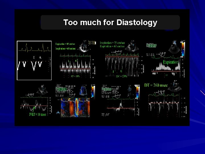 Too much for Diastology 