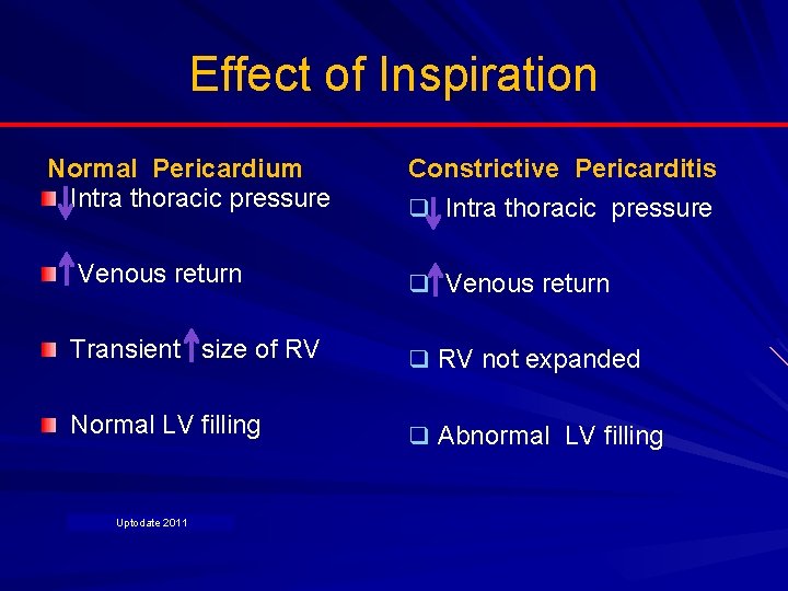 Effect of Inspiration Normal Pericardium Intra thoracic pressure Venous return Constrictive Pericarditis q Intra