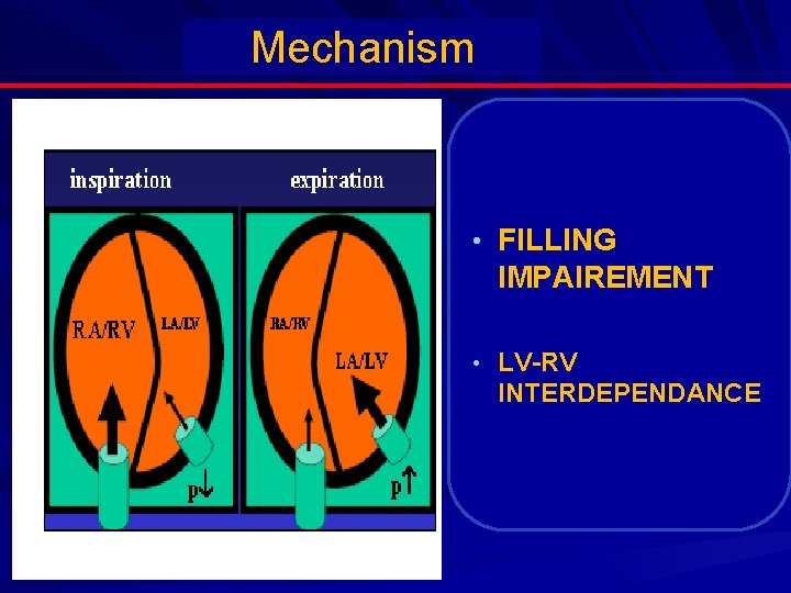 Mechanism • FILLING IMPAIREMENT • LV-RV INTERDEPENDANCE 