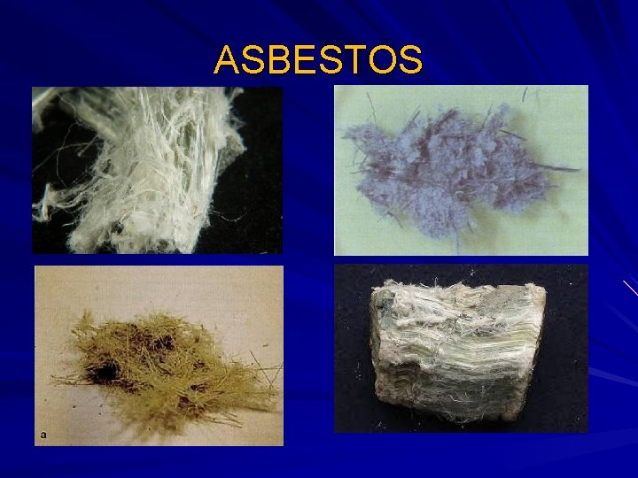 ASBESTOS 